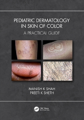 Pediatric Dermatology in Skin of Color - Manish K Shah, Preeti K Sheth