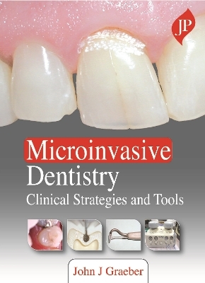 Microinvasive Dentistry - John J Graeber