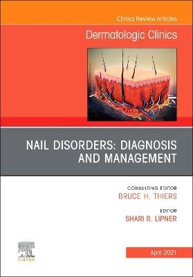 Nail Disorders: Diagnosis and Management, An Issue of Dermatologic Clinics - 