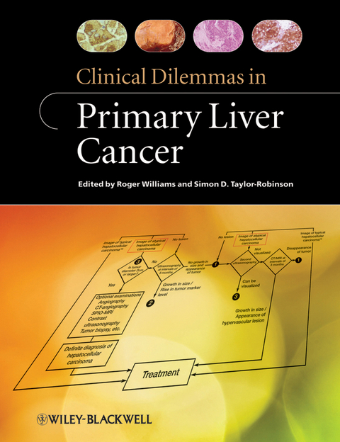 Clinical Dilemmas in Primary Liver Cancer - 