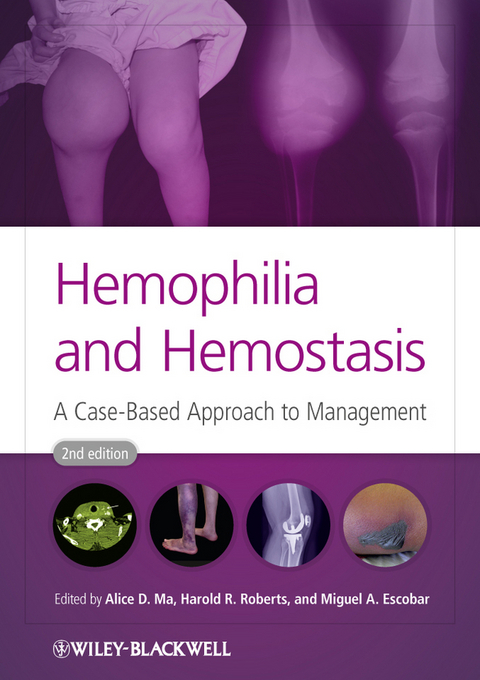 Hemophilia and Hemostasis - 