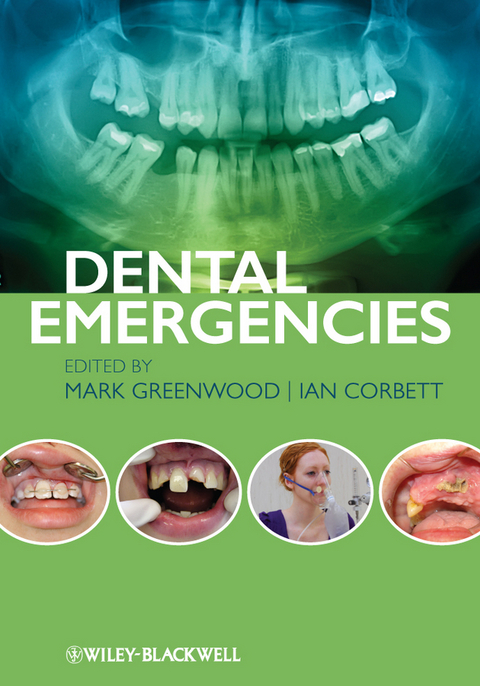 Dental Emergencies - Mark Greenwood, Ian Corbett