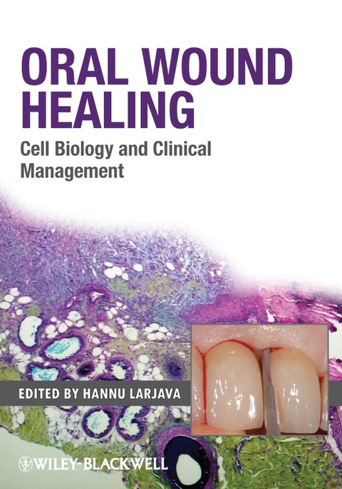 Oral Wound Healing - 