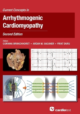 Current Concepts in Arrhythmogenic Cardiomyopathy, Second Edition - 