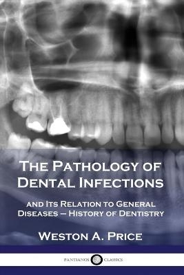 The Pathology of Dental Infections - Weston A Price