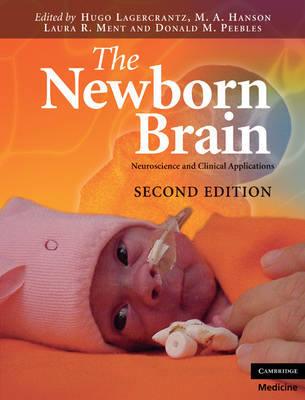 Newborn Brain - 