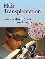 Hair Transplantation -  Marc R. Avram,  Nicole E. Rogers