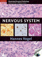 Nervous System -  Hannes Vogel