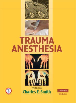 Trauma Anesthesia - 