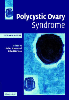 Polycystic Ovary Syndrome - 