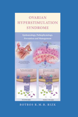 Ovarian Hyperstimulation Syndrome -  Botros Rizk