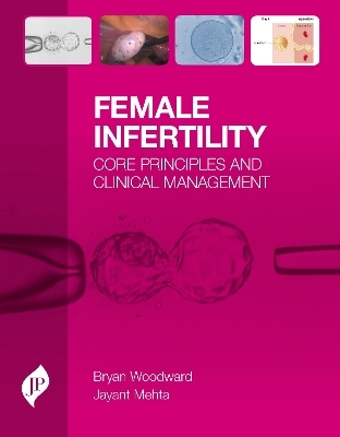 Female Infertility - Bryan Woodward, Jayant Mehta