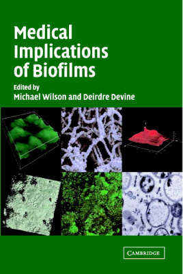 Medical Implications of Biofilms - 