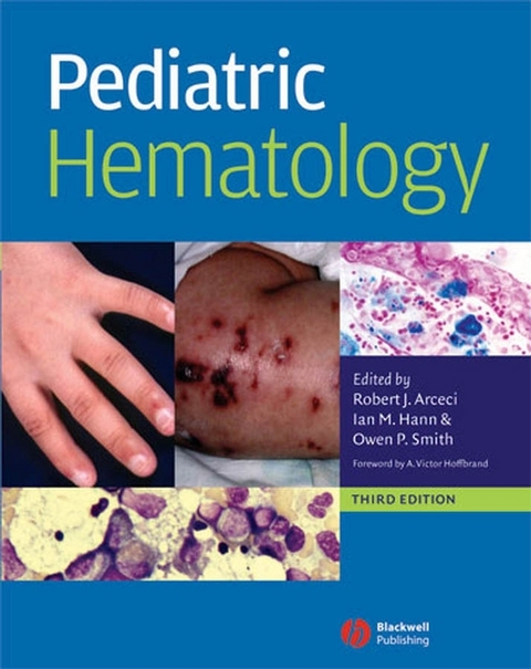 Pediatric Hematology - 