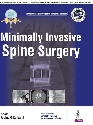 Minimally Invasive Spine Surgery - Arvind Kulkarni