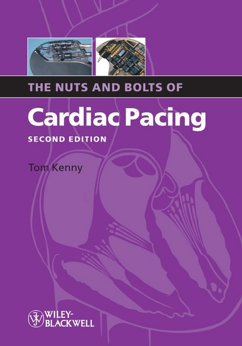 Nuts and Bolts of Cardiac Pacing -  Tom Kenny