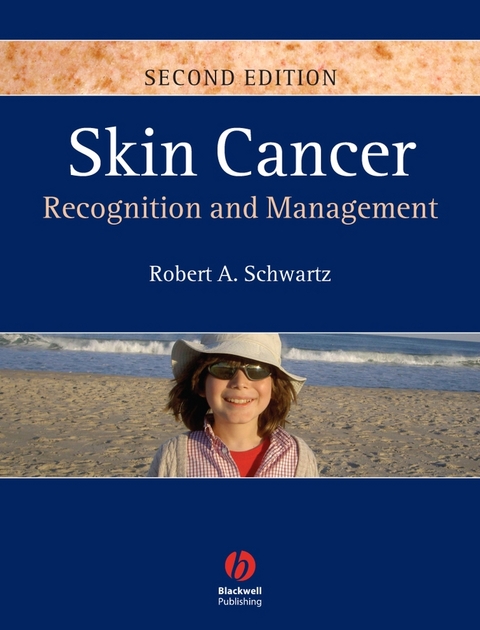 Skin Cancer - Robert A. Schwartz