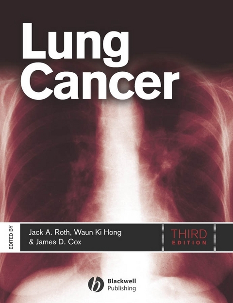 Lung Cancer - 