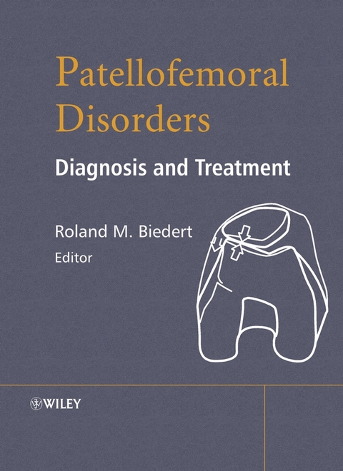 Patellofemoral Disorders - 