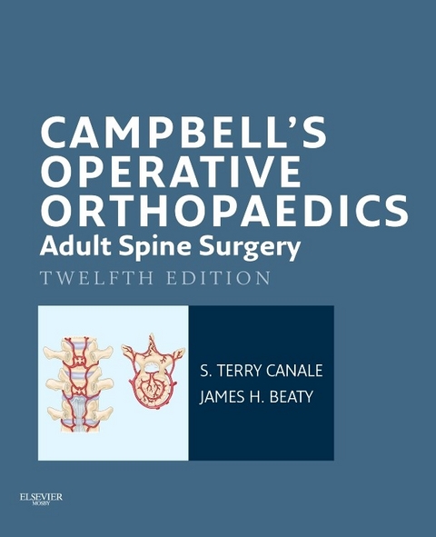 Campbell's Operative Orthopaedics: Adult Spine Surgery E-Book -  James H. Beaty,  S. Terry Canale