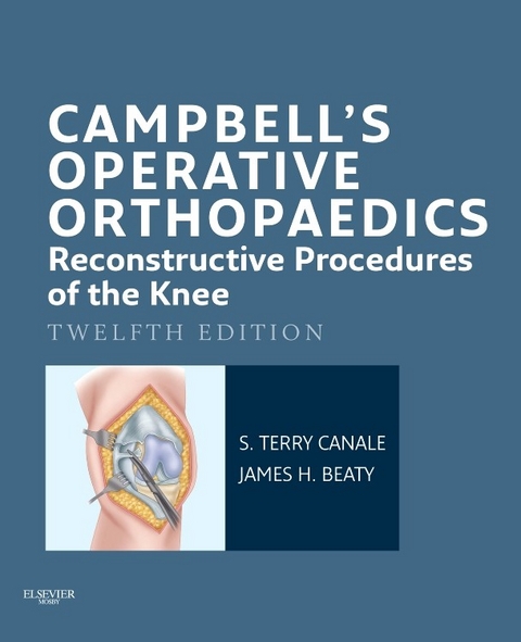 Campbell's Operative Orthopaedics: Reconstructive Procedures of the Knee E-Book -  James H. Beaty,  S. Terry Canale