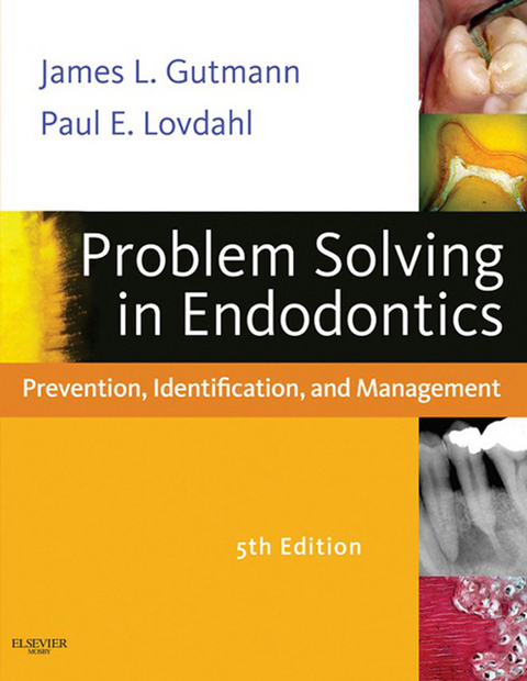 Problem Solving in Endodontics -  James L. Gutmann,  Paul E. Lovdahl