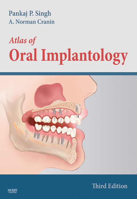 Atlas of Oral Implantology -  Pankaj Singh,  A. Norman Cranin