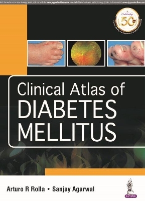 Clinical Atlas of Diabetes Mellitus - Arturo R Rolla, Sanjay Agarwal