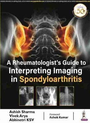 A Rheumatologist's Guide to Interpreting Imaging in Spondyloarthritis - ASHISH SHARMA, Vivek Arya, Abhinetri KSV