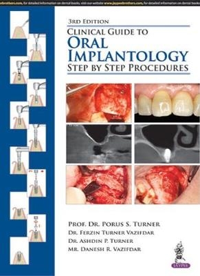 Clinical Guide to Oral Implantology - Porus S Turner, Ferzin Turner Vazifdar, Ashdin P Turner, Danesh R Vazifdar