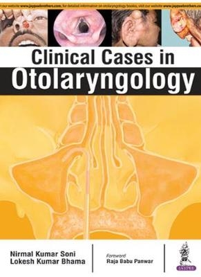 Clinical Cases in Otolaryngology - Kumar Nirmal Soni, Kumar Lokesh Bhama