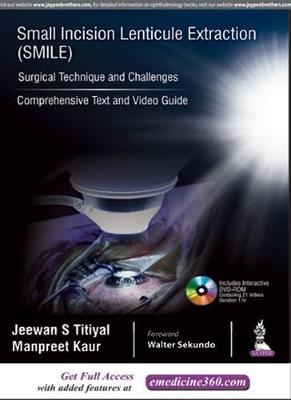 Small Incision Lenticule Extraction (SMILE): Surgical Technique and Challenges - Jeewan S Titiyal, Manpreet Kaur