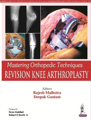 Mastering Orthopedic Techniques: Revision Knee Arthroplasty - Rajesh Malhotra, Deepak Gautam