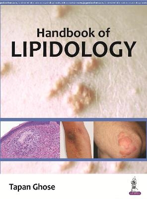 Handbook of Lipidology - Tapan Ghose