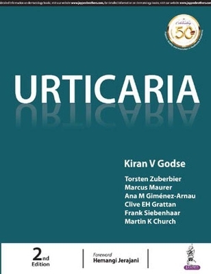 Urticaria - 