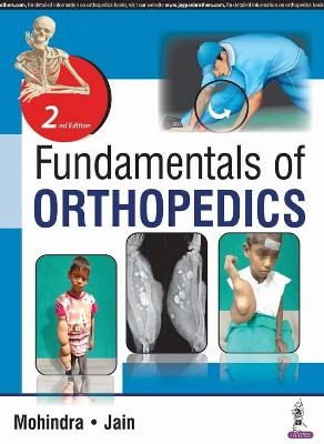 Fundamentals of Orthopedics - Mukul Mohindra, Jitesh Kumar Jain