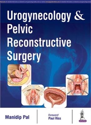 Urogynecology & Pelvic Reconstructive Surgery - Manidip Pal