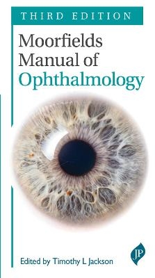 Moorfields Manual of Ophthalmology - Timothy L Jackson