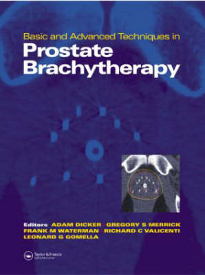 Basic and Advanced Techniques in Prostate Brachytherapy - 