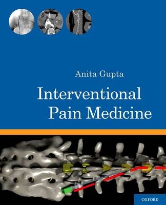 Interventional Pain Medicine - 