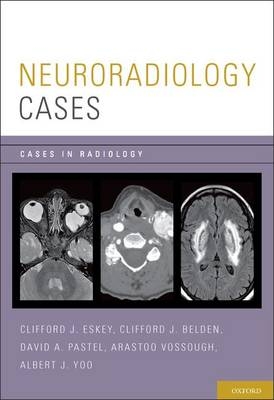 Neuroradiology Cases -  Clifford J. Belden,  Clifford J. Eskey,  David A. Pastel,  Arastoo Vossough,  Albert J. Yoo