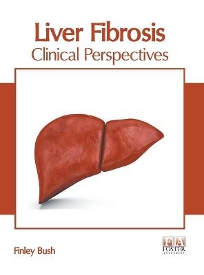 Liver Fibrosis: Clinical Perspectives - 