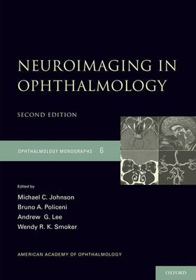 Neuroimaging in Ophthalmology -  Michael C. Johnson,  Andrew G. Lee,  Bruno Policeni,  Wendy R.K. Smoker