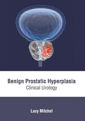 Benign Prostatic Hyperplasia: Clinical Urology - 