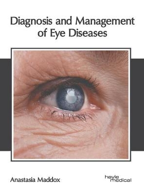 Diagnosis and Management of Eye Diseases - 