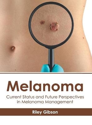 Melanoma: Current Status and Future Perspectives in Melanoma Management - 