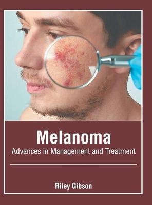 Melanoma: Advances in Management and Treatment - 