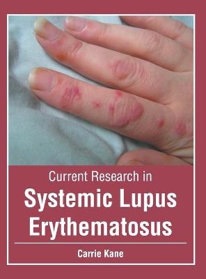 Current Research in Systemic Lupus Erythematosus - 