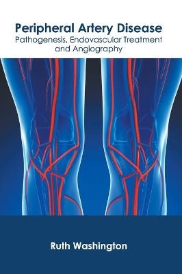 Peripheral Artery Disease: Pathogenesis, Endovascular Treatment and Angiography - 