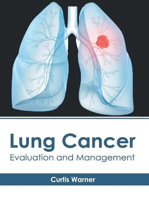 Lung Cancer: Evaluation and Management - 